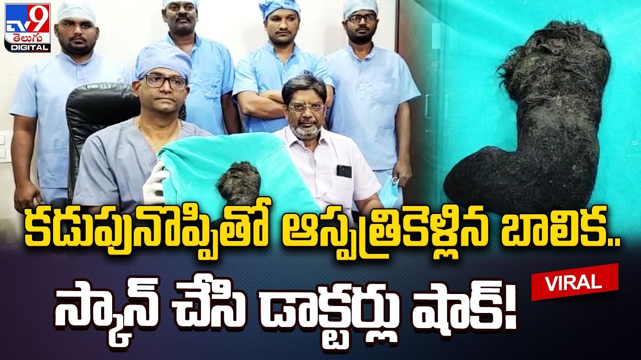 కడుపునొప్పితో ఆస్పత్రి కెళ్లిన బాలిక.. స్కాన్ చేసి డాక్టర్లు షా